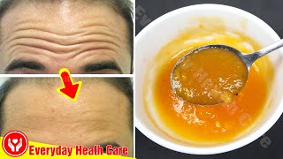 Get Rid Of Forehead Wrinkles And Deep Wrinkles Only With This Mixture Apply It To Look Younger [upl. by Fulcher]