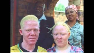 Albinism [upl. by Wallford]