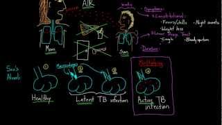 Symptoms and Spread of Tuberculosis [upl. by Attaynek]