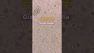 Giardia lamblia under the microscope laboratory microscope mls cls medtechstudent [upl. by Jareb]