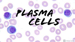 Plasma Cells on Peripheral Blood Smear Hemepath Hematology Pathology [upl. by Nahta24]