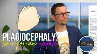 What is PLAGIOCEPHALY An UPDATE in 2022 [upl. by Morten15]