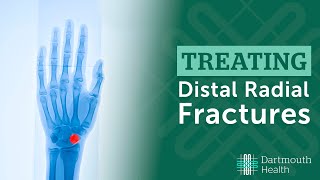 Treating Distal Radius Fractures at Dartmouth Health [upl. by Akceber376]