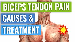 Biceps Tendonitis Treatment and Exercises Explained [upl. by Nosahc273]