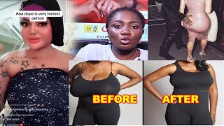 😲😲😲Eiiiii Animguase3 nie😳😳 Aba Dope shàŕès her story amp ŕèvèãls dangers in liposuction surgery [upl. by Maggy589]