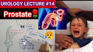 Urology surgery lecture 14 prostate BPH Prostate carcinoma zone gland [upl. by Rabiah]