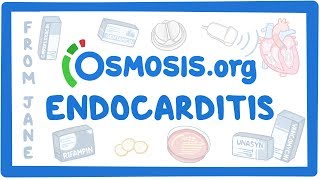 Clinicians Corner Endocarditis [upl. by Azyl30]