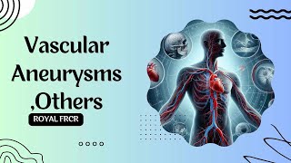 2  Vascular Imaging for FRCR [upl. by Ajssatsan]