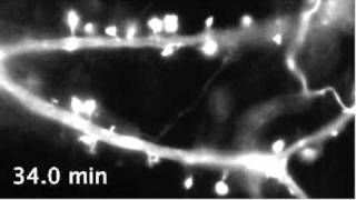 Dynamic actin filaments in dendritic spines [upl. by Garibold]