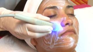 Radiofrecuencia Facial o Lifting sin cirugía [upl. by Halika462]