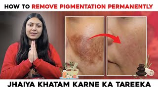 How to remove Pigmentation Permanently  Best Home Remedies  Skin Care Tips  Upasana Ki Duniya [upl. by Ardnot]