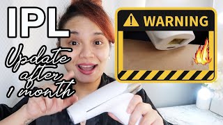 DIY Permanent Hair Removal IPL UPDATE after 1 MONTH Lescolton IPL [upl. by Andeee]