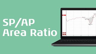 Using the SPAP Area Ratio for Diagnosis of Menieres Disease [upl. by Melantha65]