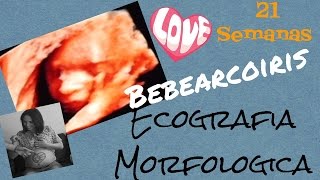 Ecografia morfologica del bebe 21 semanasmama [upl. by Fiora795]