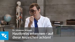 Hautkrebs selbst erkennen  auf diese Anzeichen müsst ihr achten  Dr Johannes Wimmer [upl. by Malvino]