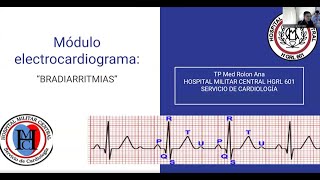 Bradiarritmias [upl. by Atahs]