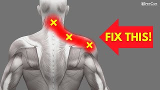 How to INSTANTLY Fix Pinched Nerve Pain in the Neck and Shoulders [upl. by Nnylamme651]