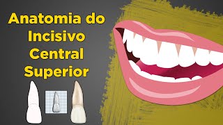 Anatomia do Incisivo Central Superior  Resumo de Anatomia Dental  Dente 11 e 21 [upl. by Ebarta]