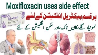 moxifloxacin 400 mg uses in urdu moxifloxacin 400 mg  Mofest 400mg  X gen 400mg  Avelox 400mg [upl. by Paterson]