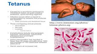 Tetanus  Epidemiology and Associated Complications [upl. by Dayle]