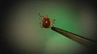 All the rain means an uptick in ticks [upl. by Yrdnal]