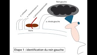 Echographie des surrénales en vidéo [upl. by Ralat]