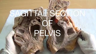 SAGITTAL SECTION OF PELVIS  DEMONSTRATION  ANATOMY [upl. by Nylatsirk]