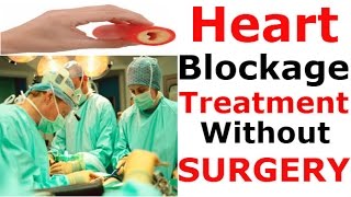 Heart blockage treatment without surgery  Natural Home Remdies As Medicine For ANGIOPLASTY [upl. by Scevo]