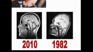 MRI Basics 1 شرح الرنين المغناطيسي [upl. by Atteoj]