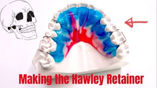 Making a Hawley Retainer [upl. by Eimarej]