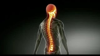 Paraplegic Info  What is Paraplegia [upl. by Inneg]