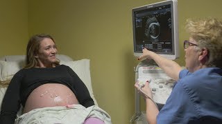 Ultrasounds during pregnancy [upl. by Afirahs879]