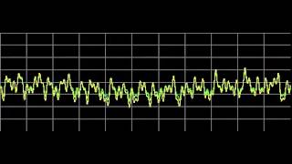 Kidney Diseases  Rife Frequencies [upl. by Midis]