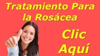 Tratamiento Natural Casero de Manzanilla para el Acne Rosacea [upl. by Tereve]