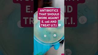 The antibiotics are AMIKACINAK MEROPENEMMEM CIPROFLOXACINCIP TAZOBACTAMTZP AND GENTAMICINCN [upl. by Arty]