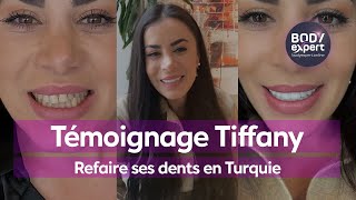 SOINS DENTAIRES EN TURQUIE  🦷 Témoignage Tiffany  22 couronnes Emax  BODYEXPERT [upl. by Torbart130]