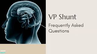 VP Shunt Frequently Asked Questions [upl. by Anuahs320]