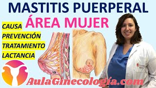 MASTITIS PUERPERAL CAUSAS DIAGNÓSTICO TRATAMIENTO LACTANCIA  Ginecología y obstetricia [upl. by Karen]