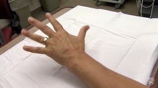 Mayo Clinic Minute What may be causing your hands and feet to tingle [upl. by Eb]