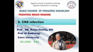 CNS Infections in Pediatrics [upl. by Templeton]