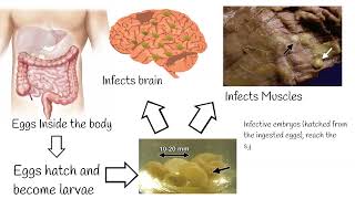 Neurocisticcircosis symptoms and treatment Why is pork tapeworm so dangerous [upl. by Einomrah]