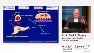 Vascular calcification in CKD patients  Prof Ziad A Massy [upl. by Inilahs]