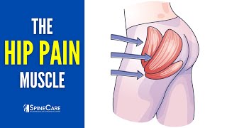 The Hip Pain Muscle How to Release It for INSTANT RELIEF [upl. by Plerre]