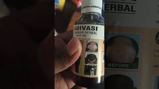 Ekart Logistics reviews Fake product delivery old and dirty  PissedConsumercom [upl. by Ynnol]