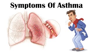 Asthma Symptoms  What Are The Major Symptoms Of Asthma [upl. by Lindsey]