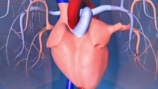 Catheter Ablation What is it and how does it help an irregular heart beat [upl. by Bernardina]