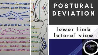 POSTURAL DEVIATION LATERAL VIEW LOWERE LIMB Posture BiomechanicsPhysiotherapy Tutorial [upl. by Denyse]