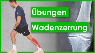 Wadenzerrung🦵Muskelfaserriss Übungen⎮RehaProgramm [upl. by Eyks]