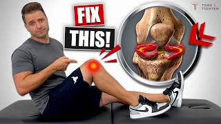 Fix Meniscus Tear Without Surgery Knee Pain Relief Exercises [upl. by Annawak]