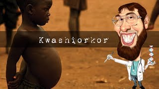 Você sabe o que é Kwashiorkor Biologia  Pergunta Pro Toid [upl. by Annhej214]